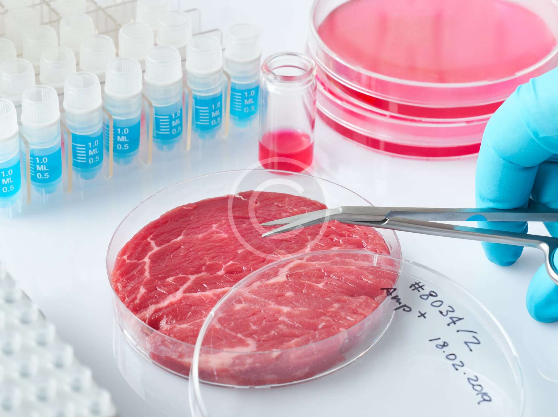Biochemical blood test